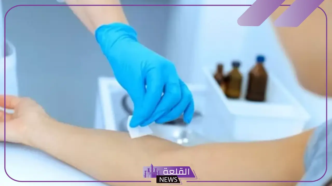تجربتي مع الفصد وأبرز الأمراض التي يعالجها 6 العلاج بالفصد