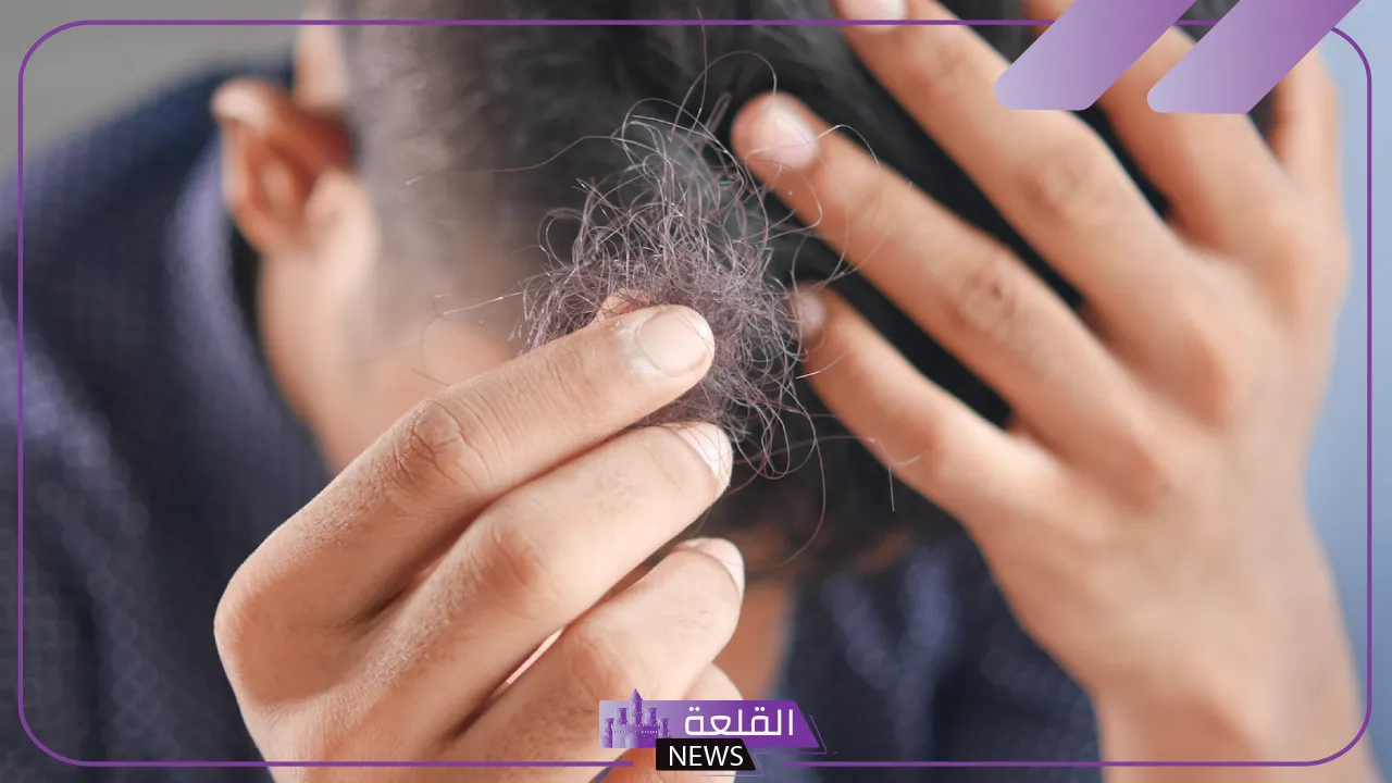 تفسير حلم الصلع في جزء من الرأس في المنام للأعزب والمتزوج 6 تفسير الصلع في المنام للمطلقة