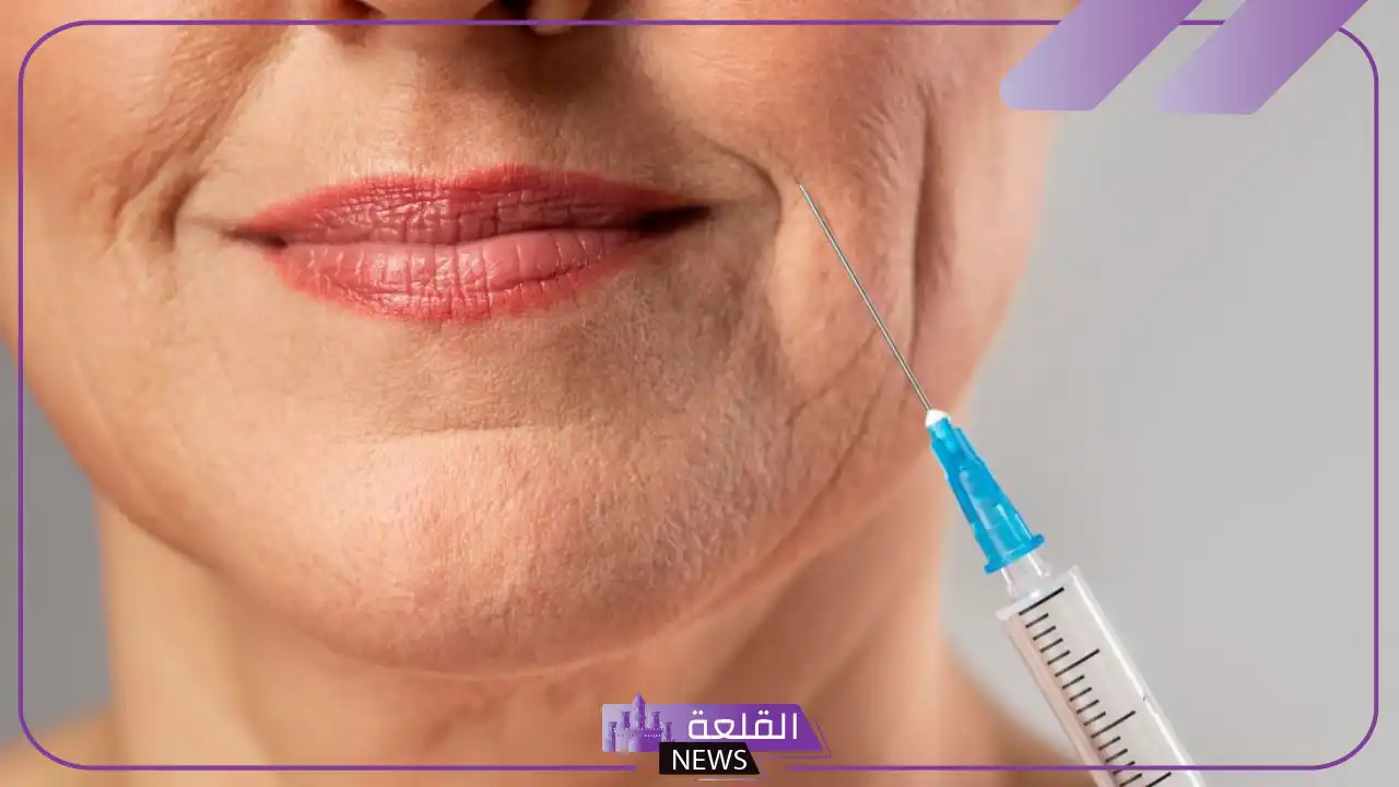 تجربتي مع ابرة البروفايلو لشد ترهلات الوجه وأبرز مميزاتها 6 بروفايلو للوجه قبل وبعد