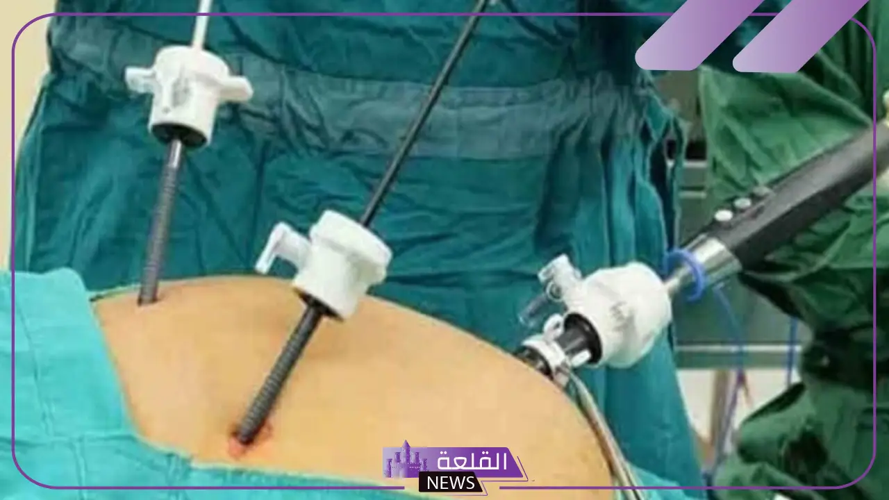 تجربتي مع منظار المعده "كل ما تحتاج لمعرفته" 6 أضرار منظار المعدة