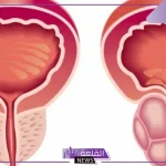 تجربتي مع تدليك البروستاتا وأهم فوائده