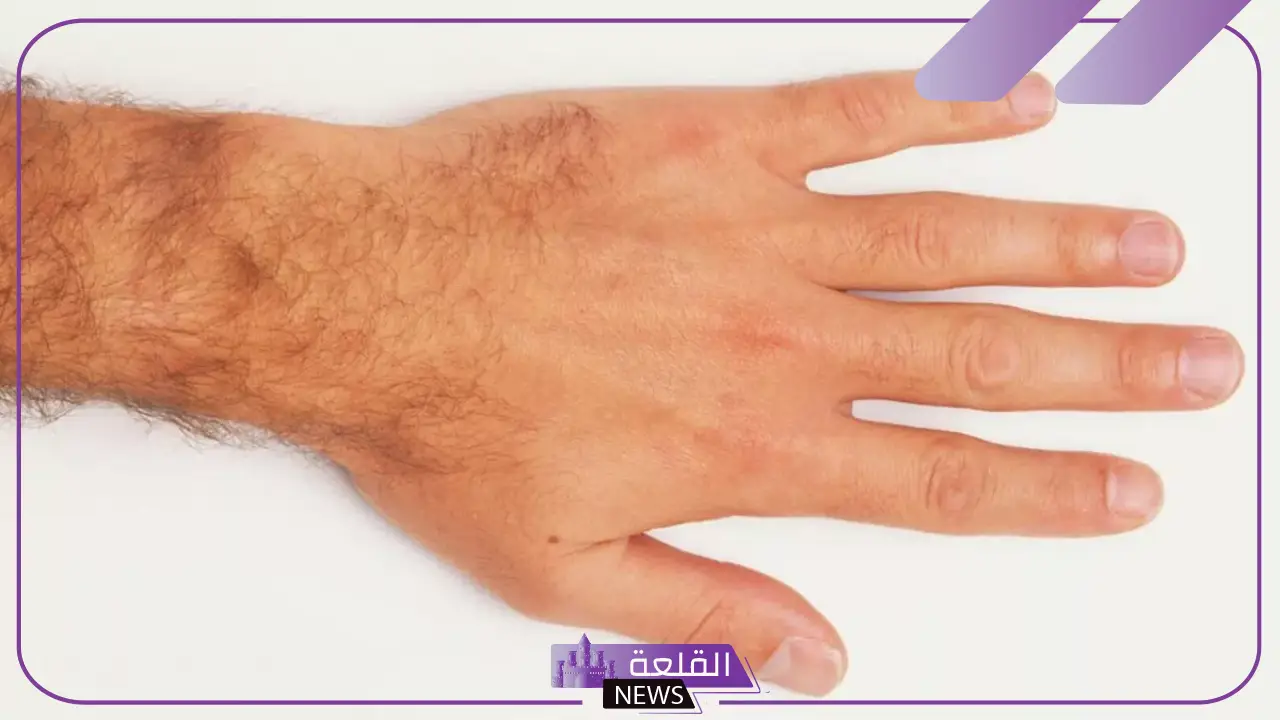تفسير حلم رؤية شعر الذراع في المنام للعزباء لابن سيرين 5 شعر الذراع لابن سيرين