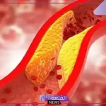 يحمي القلب ويقوي المناعة.. أفضل نوع عصير يحارب الكوليسترول الضار
