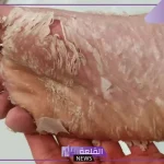 تفسير حلم رؤية إزالة الجلد الميت من القدم في المنام لابن سيرين