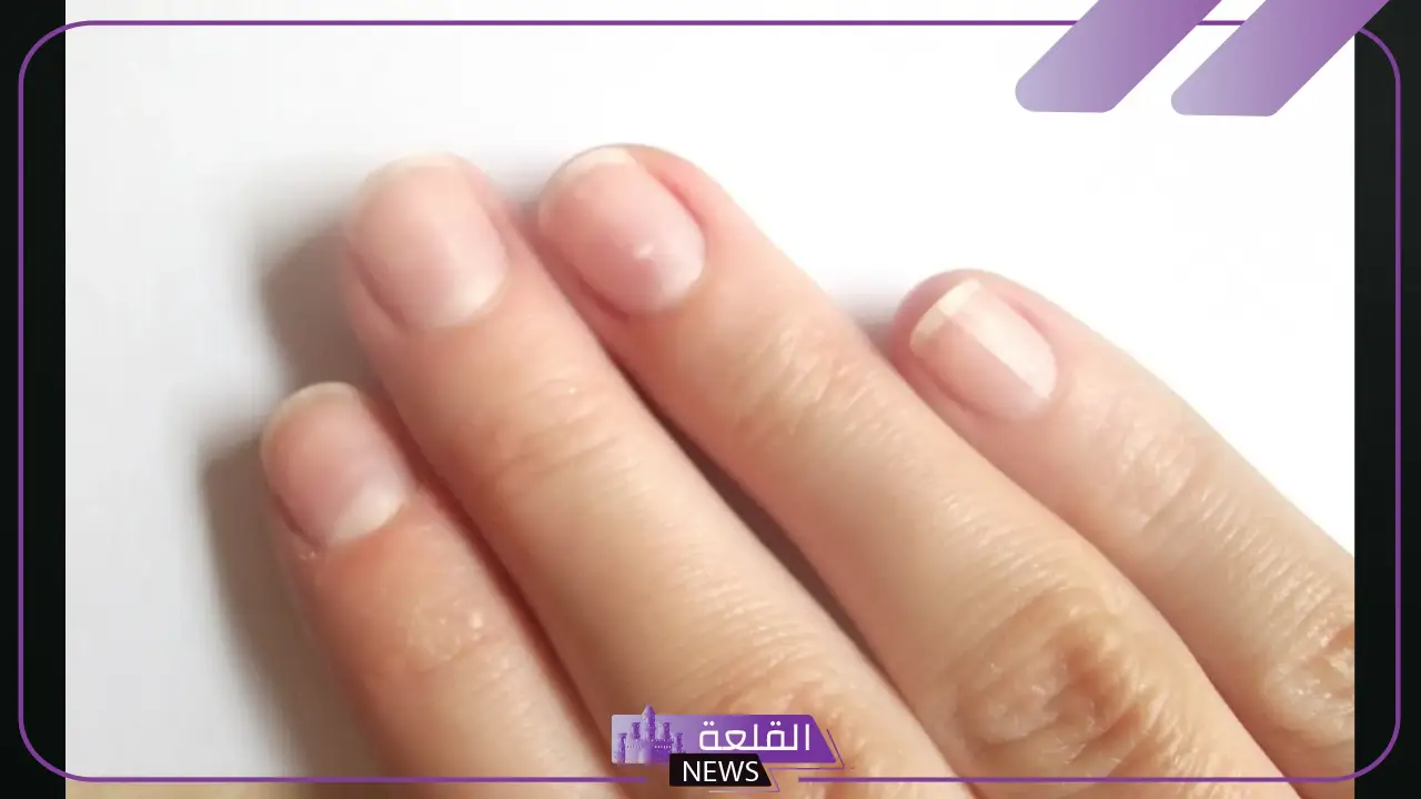 تفسير حلم رؤية الفرقعة في المنام.. دلالة فرقعة الأصابع في المنام 5 الأصابع للنابلسي