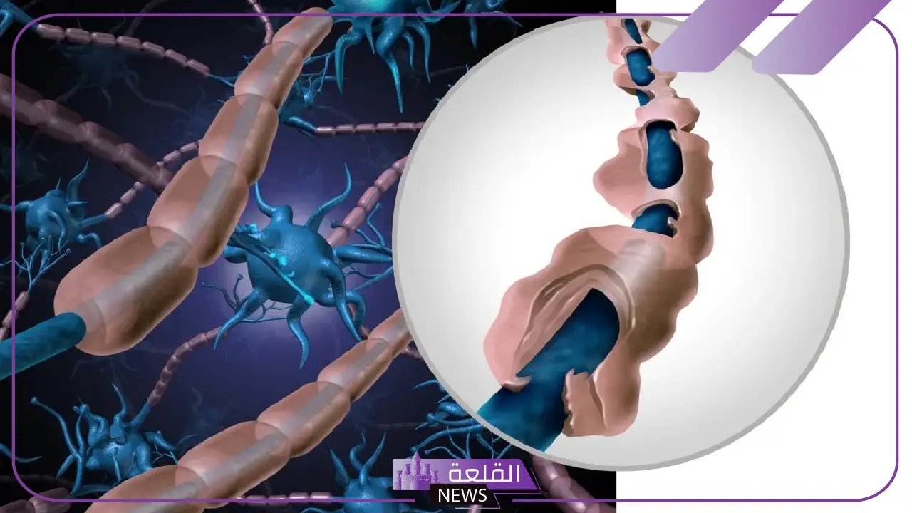 إنجاز جديد.. الحربي يعلن إنجاز بحث علمي جديد بمجال التصلب العصبي المتعدد 5 الحربي يحقق إنجازًا علميًا بنشر بحث عن التصلب العصبي المتعدد
