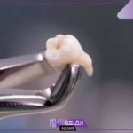 تفسير حلم خلع الأسنان باليد بدون ألم في المنام لابن سيرين