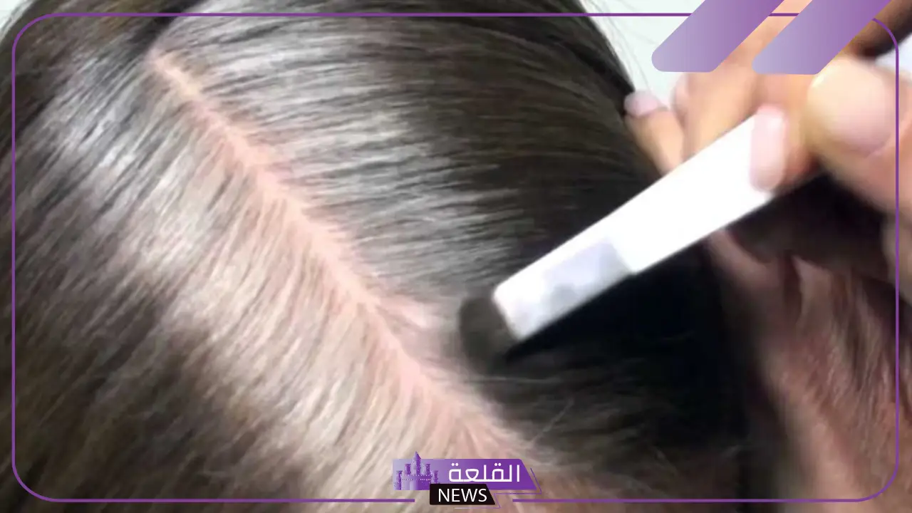 خلطة للشيب مجربة هترجعك شباب مضمونة وفعالة 5 علاج الشيب