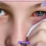 تفسير حلم فقدان عين واحدة في المنام للرجل والمرأة