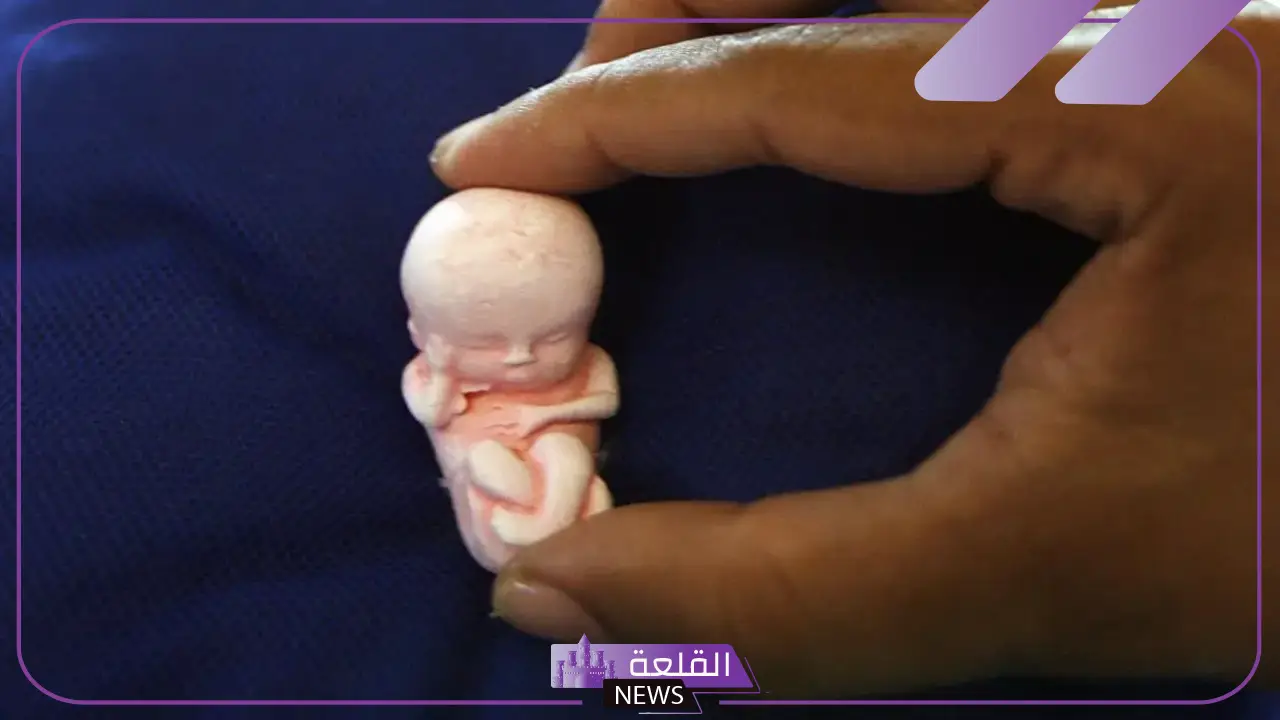 تفسير حلم الاجهاض في المنام للحامل والمتزوجة لابن سيرين 5 معنى حلم الإجهاض