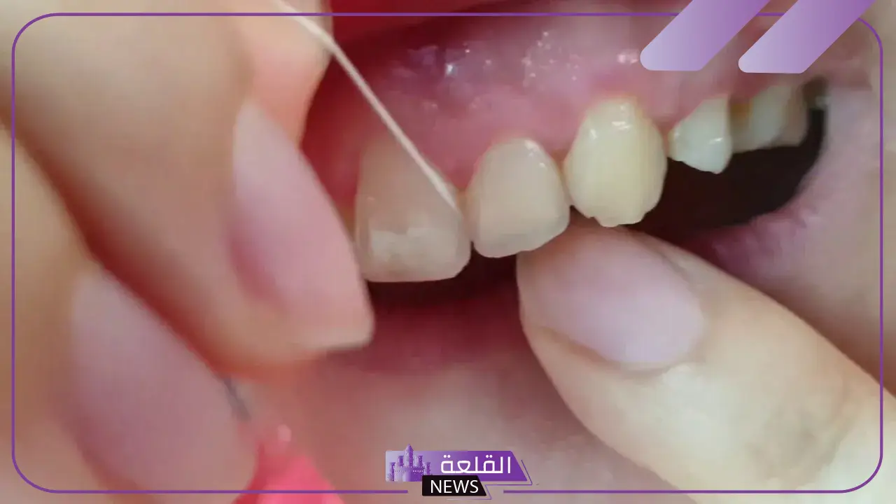تفسير حلم تفريش الاسنان في المنام وفقًا لابن سيرين 6 تنظيف الاسنان في المنام