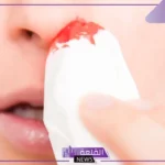 تفسير حلم خروج الدم من الانف في المنام للمرأة والرجل لابن سيرين