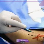 تفسير حلم عملية جراحية في البطن للحامل والمتزوجة لابن سيرين 