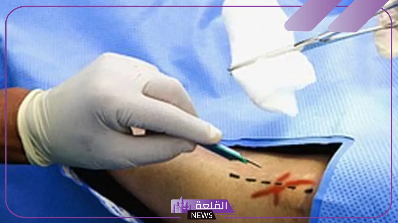 تفسير حلم عملية جراحية في البطن للحامل والمتزوجة لابن سيرين 