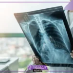 كم يصل راتب اخصائي اشعة في السعودية مع البدلات 1446