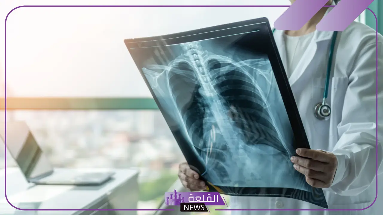 كم يصل راتب اخصائي اشعة في السعودية مع البدلات 1446