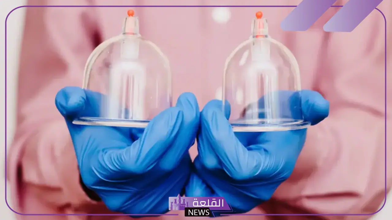 فوائد الحجامة للعين والحسد والسحر.. علامات خروج السحر بعد الحجامة 