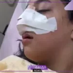 شاهد.. ألفاظ نابية وكسور وإصابات بالغة في خناقة بنات مدرسة التجمع!