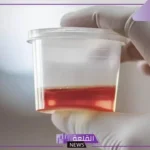 حلمت اني اتبول دم في المنام للعزباء والمتزوجة لابن سيرين