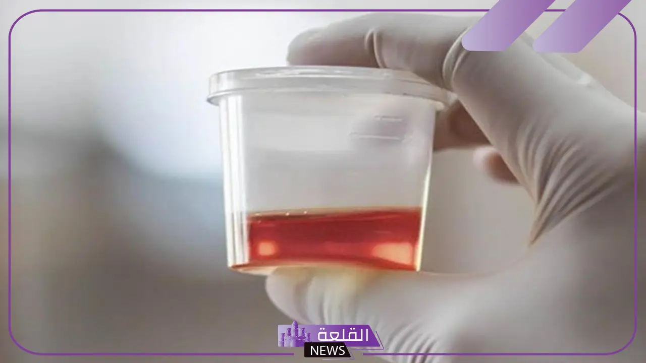 حلمت اني اتبول دم في المنام للعزباء والمتزوجة لابن سيرين 1 حلمت اني اتبول دم مع البول للعزباء