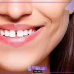 تفسير حلم الاسنان الامامية متفرقة للزوجة والرجل ورمزها لابن سيرين