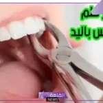 تفسير حلم خلع الأسنان باليد في المنام دون الشعور بأي ألم لابن سيرين