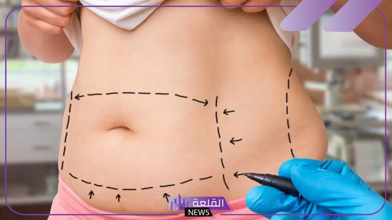 تفسير حلم عملية جراحية في البطن للمرأة والرجل لابن سيرين