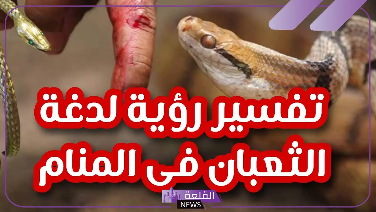 تفسير حلم لدغة الثعبان في اليد والتسمم في المنام لابن سيرين 24 تفسير حلم لدغة الثعبان في اليد والتسمم في المنام لابن سيرين