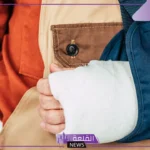 تفسير حلم كسر اليد في المنام للرجل والمرأة العزباء لابن سيرين