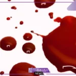 تفسير حلم الدم على الملابس البيضاء ورمزه في المنام لابن سيرين