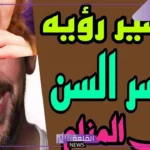 تفسير حلم السن المكسور في المنام وتكسر الأسنان لابن سيرين