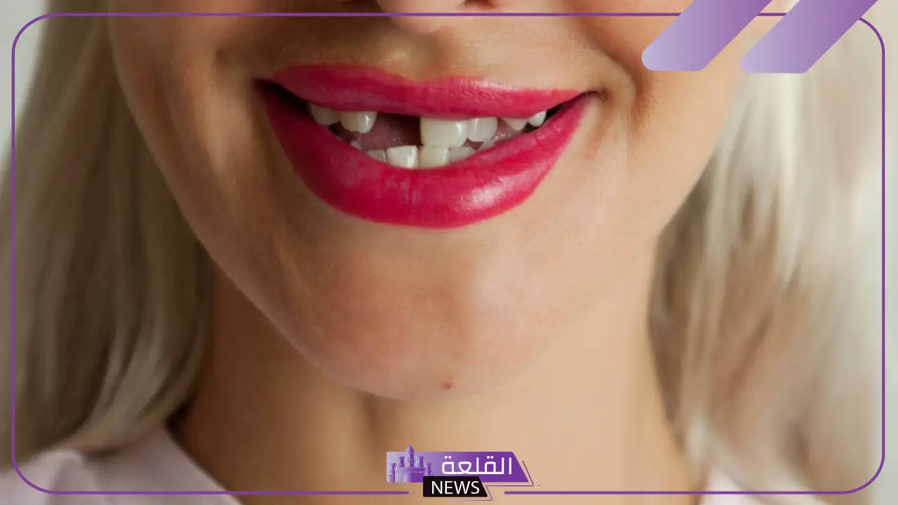 تفسير حلم انكسار السن في المنام وسقوطه لابن سيرين