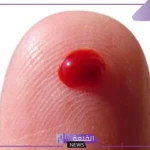 تفسير حلم الدم للعزباء والجرح لابن سيرين والنابلسي