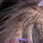 تفسير حلم الثعلبة في المنام للرجل لكبار المفسرين