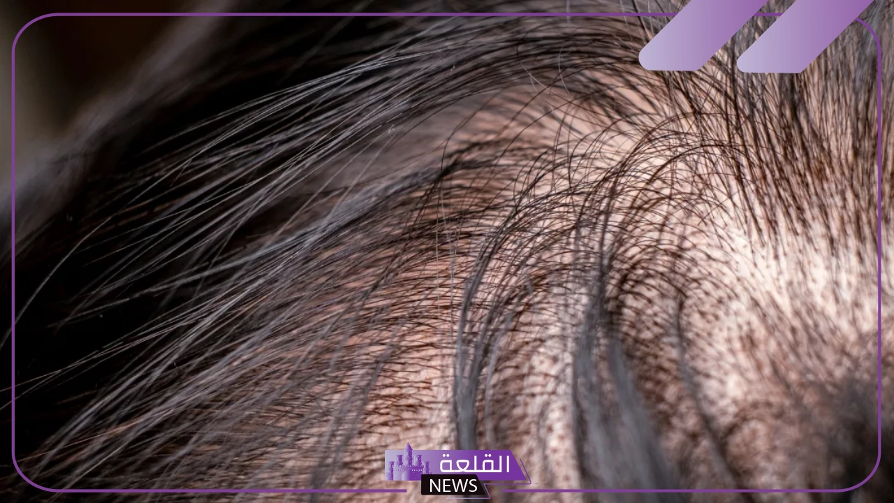 تفسير حلم الثعلبة في المنام للرجل لكبار المفسرين