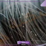 تفسير حلم الصيبان في الشعر للعزباء في المنام لابن سيرين