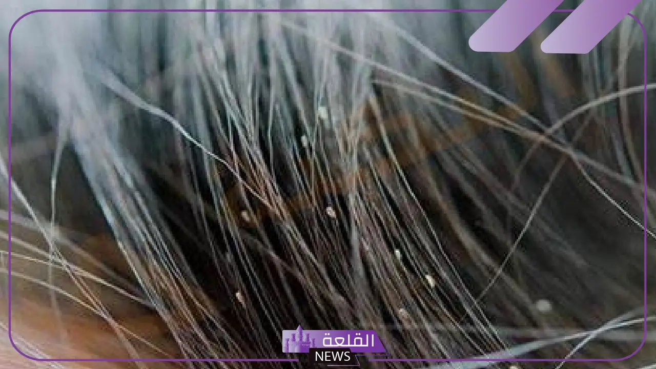 تفسير حلم الصيبان في الشعر للعزباء في المنام لابن سيرين