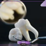 تفسير حلم خلع الضرس في المنام للمتزوجة والحامل لابن سيرين