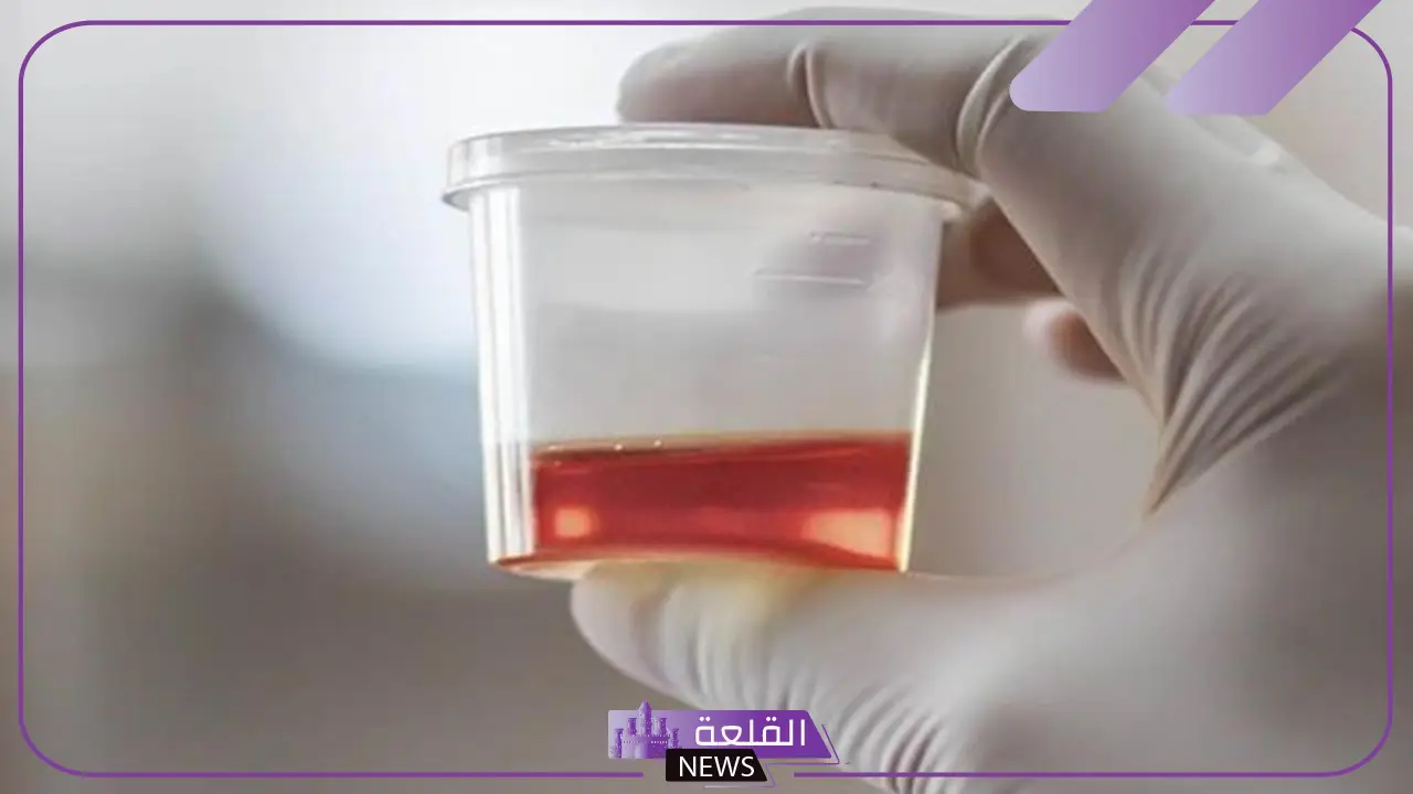 تفسير حلم البول وفيه دم للمرأة العزباء والمتزوجة في المنام 5 تفسير تبول الدم في المنام للعزباء