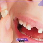 تفسير حلم سقوط الاسنان بدون دم في المنام لابن سيرين