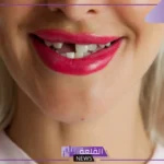تفسير حلم سقوط سن واحد فقط في المنام للعزباء والمتزوجة لابن سيرين