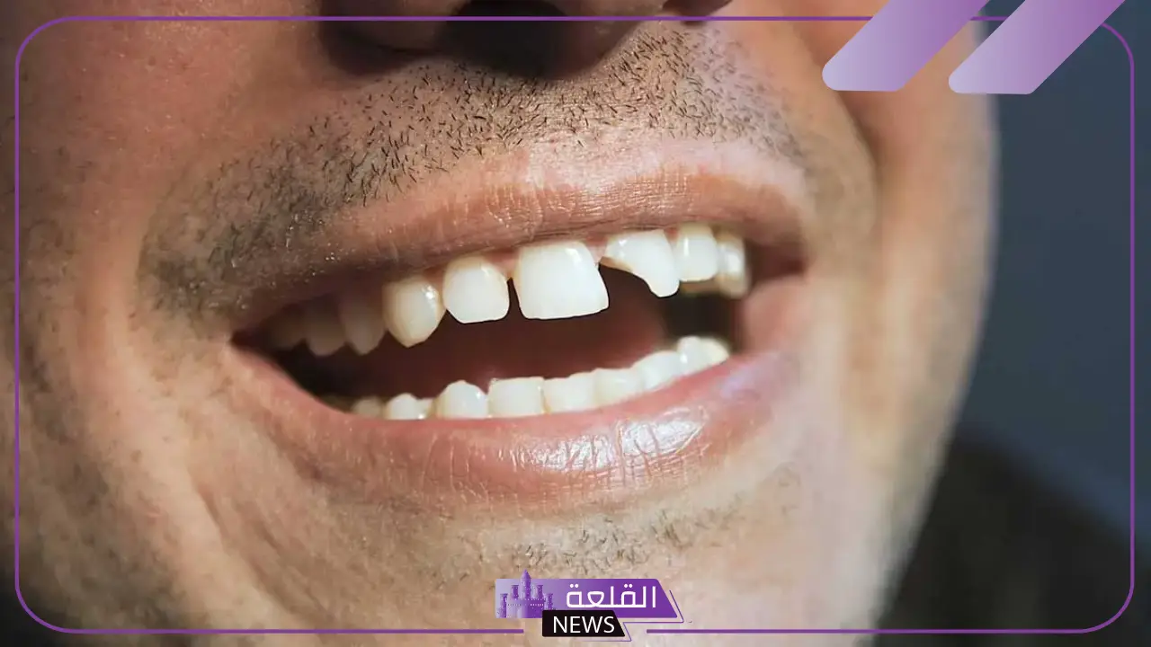تفسير حلم سقوط سن واحد فقط في المنام للعزباء والمتزوجة لابن سيرين 5 رمز سقوط السن