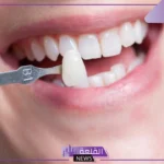 تفسير حلم تسوس الاسنان وتغير شكلها للعزباء لابن سيرين