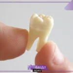 تفسير حلم خلع الضرس باليد في المنام للمرأة الحامل والعزباء بدون ألم