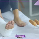 تفسير حلم كسر الرجل في المنام والجبيرة للعزباء لابن سيرين