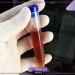 تفسير حلم التبول دم في المنام للرجل والمرأة المتزوجة لكبار العلماء