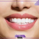 تفسير حلم الاسنان البيضاء في المنام للعزباء والمتزوجة وتبديلها
