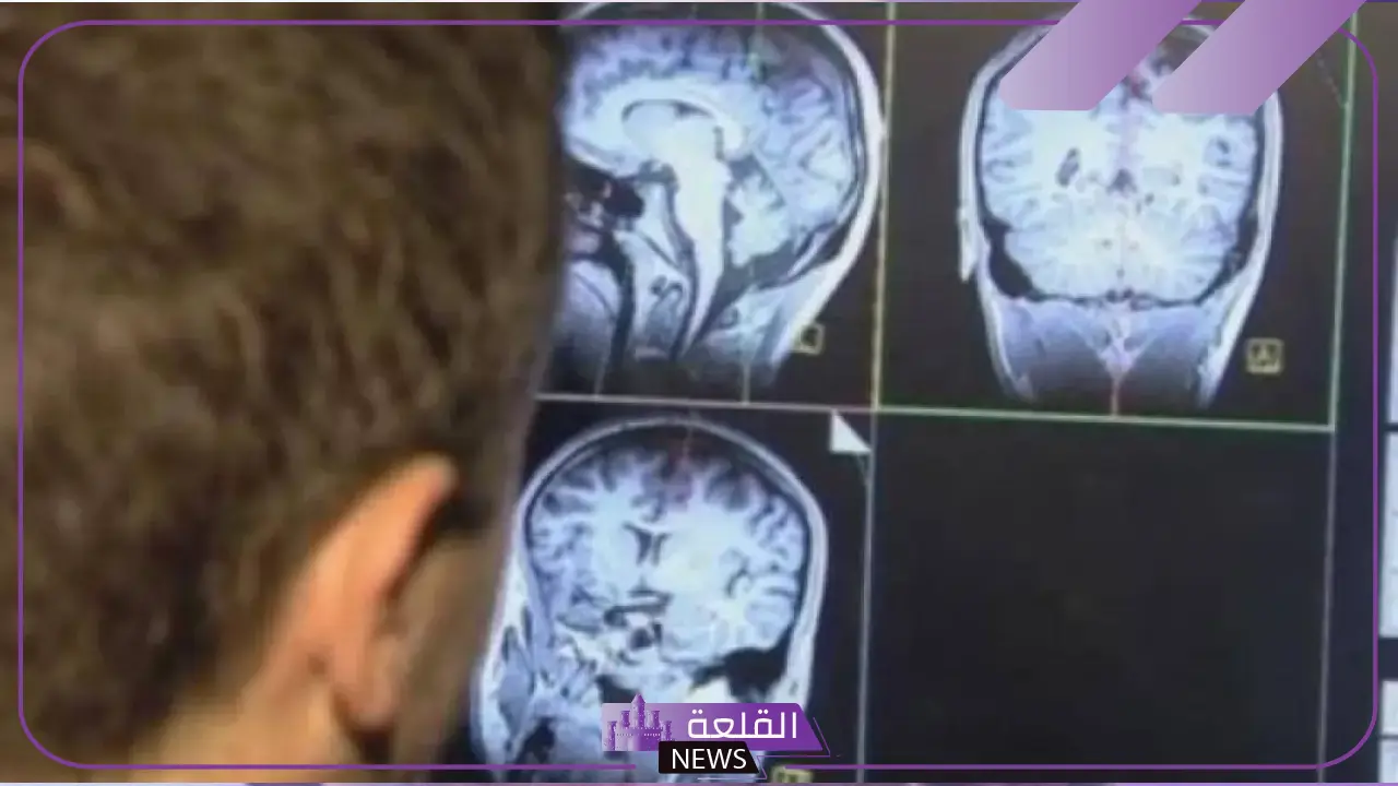 5.5 مليون حالة وفاة سنويًا.. خبيرة توضح 6 تغييرات في حياة الإنسان تحميه من السكتة الدماغية 18 5.5 مليون حالة وفاة سنويًا.. خبيرة توضح 6 تغييرات في حياة الإنسان تحميه من السكتة الدماغية