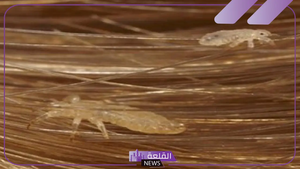 تفسير حلم القمل في الشعر وقتله للمتزوجه والحامل والعزباء 5 تفسير حلم نزع القمل من الشعر للعزباء