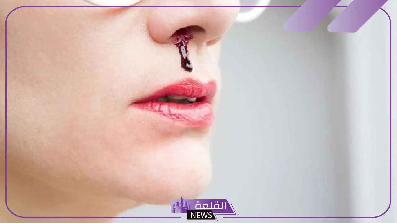 تفسير حلم نزيف الانف في المنام للمتزوجة والعزباء وخروج الدم لابن سيرين